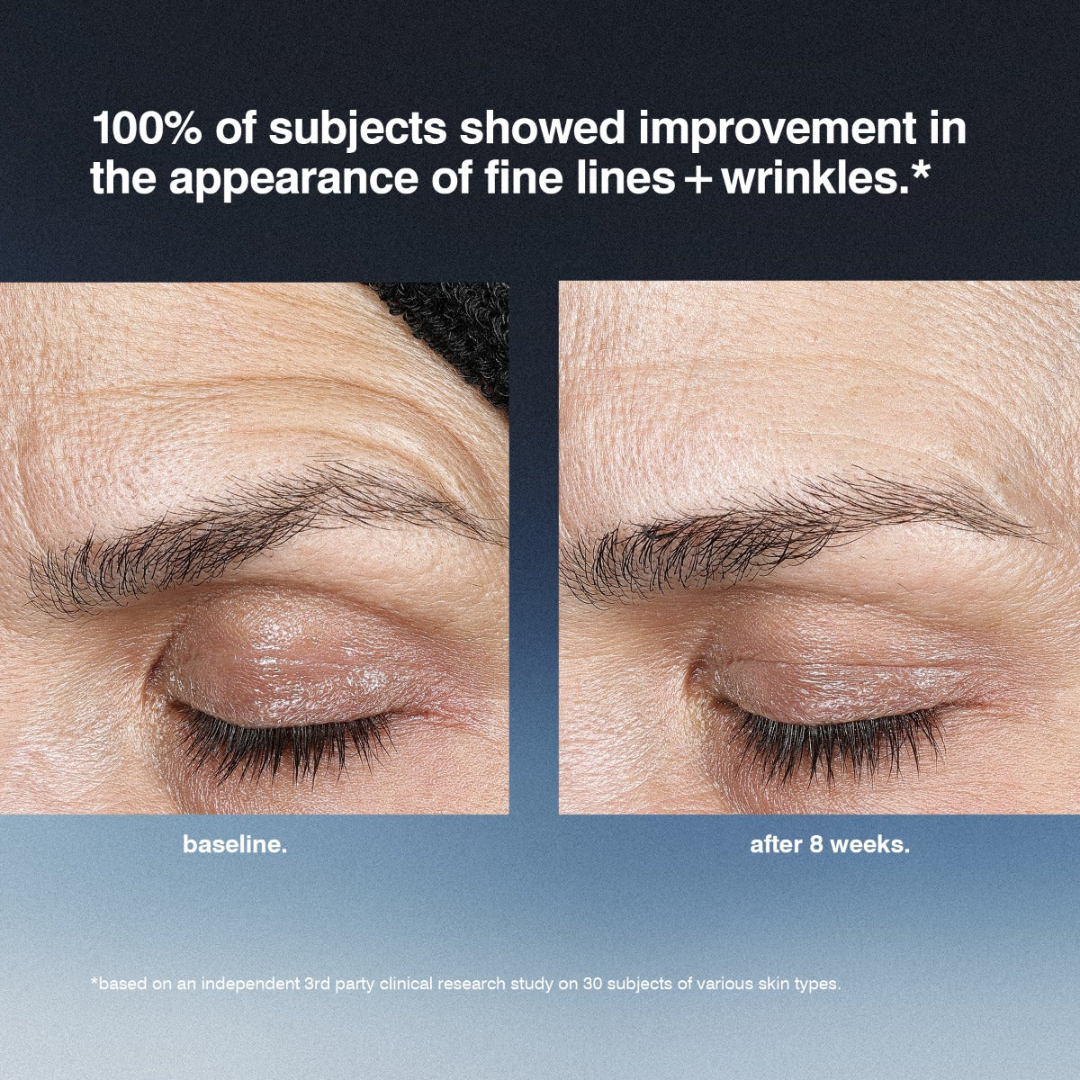 niacinamide infographic clinical b a wrinkles